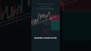 TRADING MISTAKES PART- 3 #tradingview | Stock | Market | crypto | Trading | #short