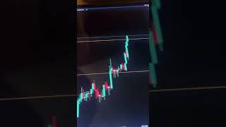 Forex Trading Profit!! || Exness || Anish Singh Thakur #shorts